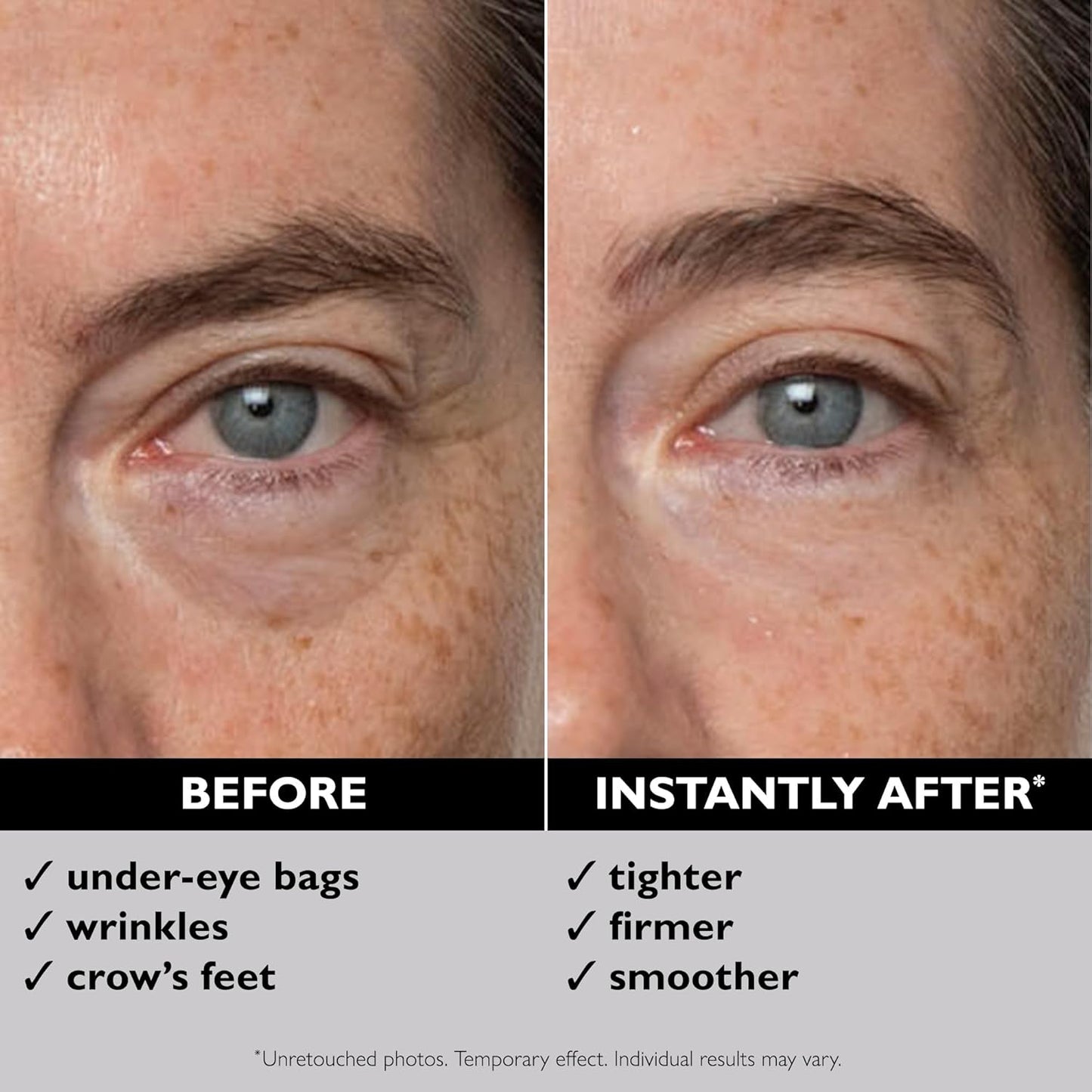 Peter Thomas Roth Instant FirmX™ Eye 30ml