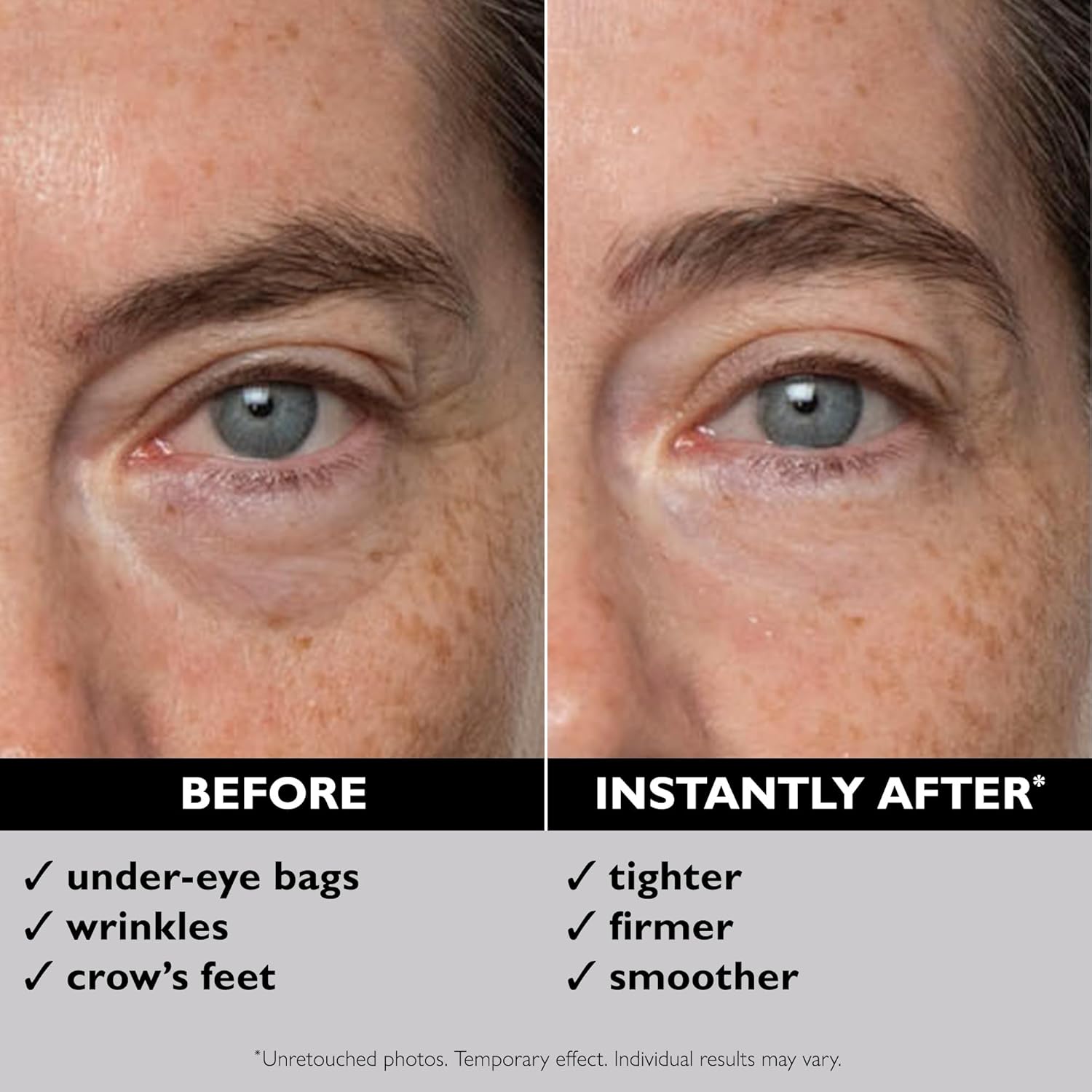 Peter Thomas Roth Instant FirmX™ Eye 30ml