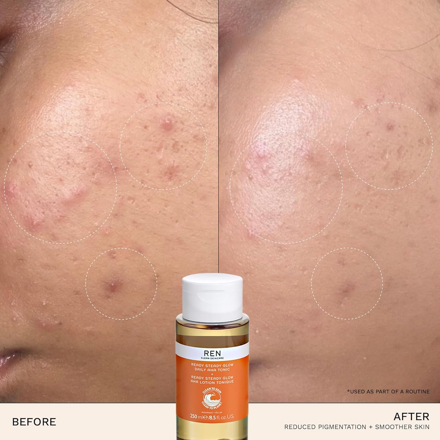 Ren toner Ready Steady Glow Daily AHA Toner