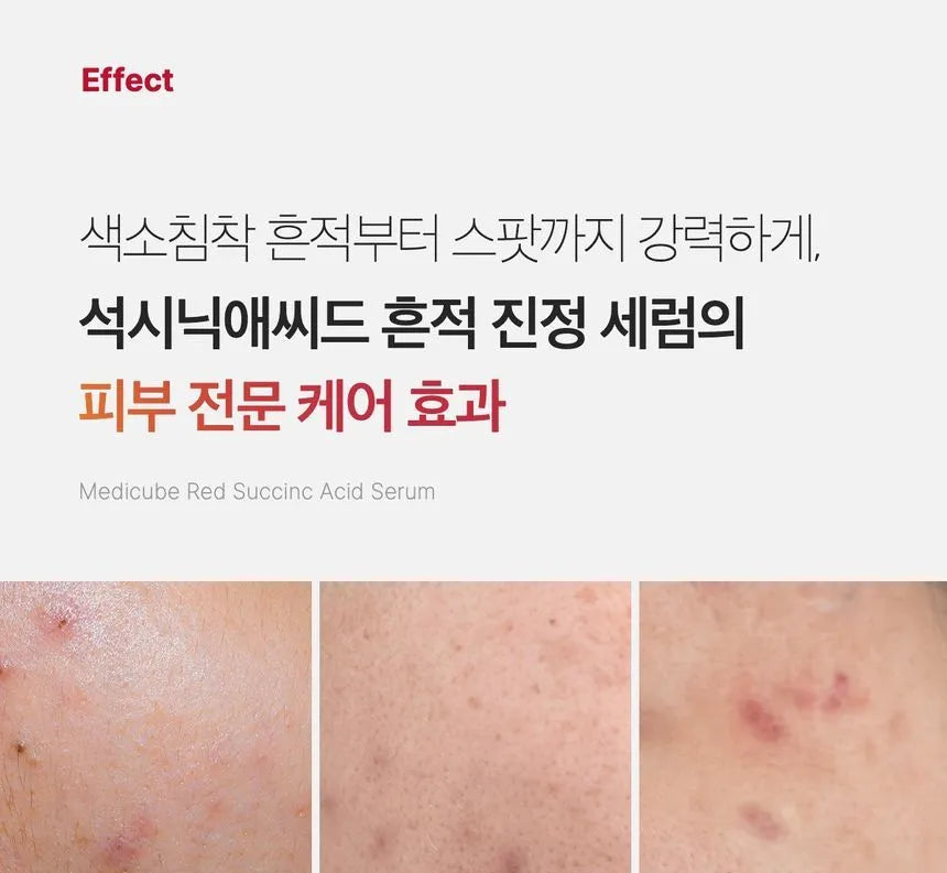 Medicube Red Succinic Acid Serum