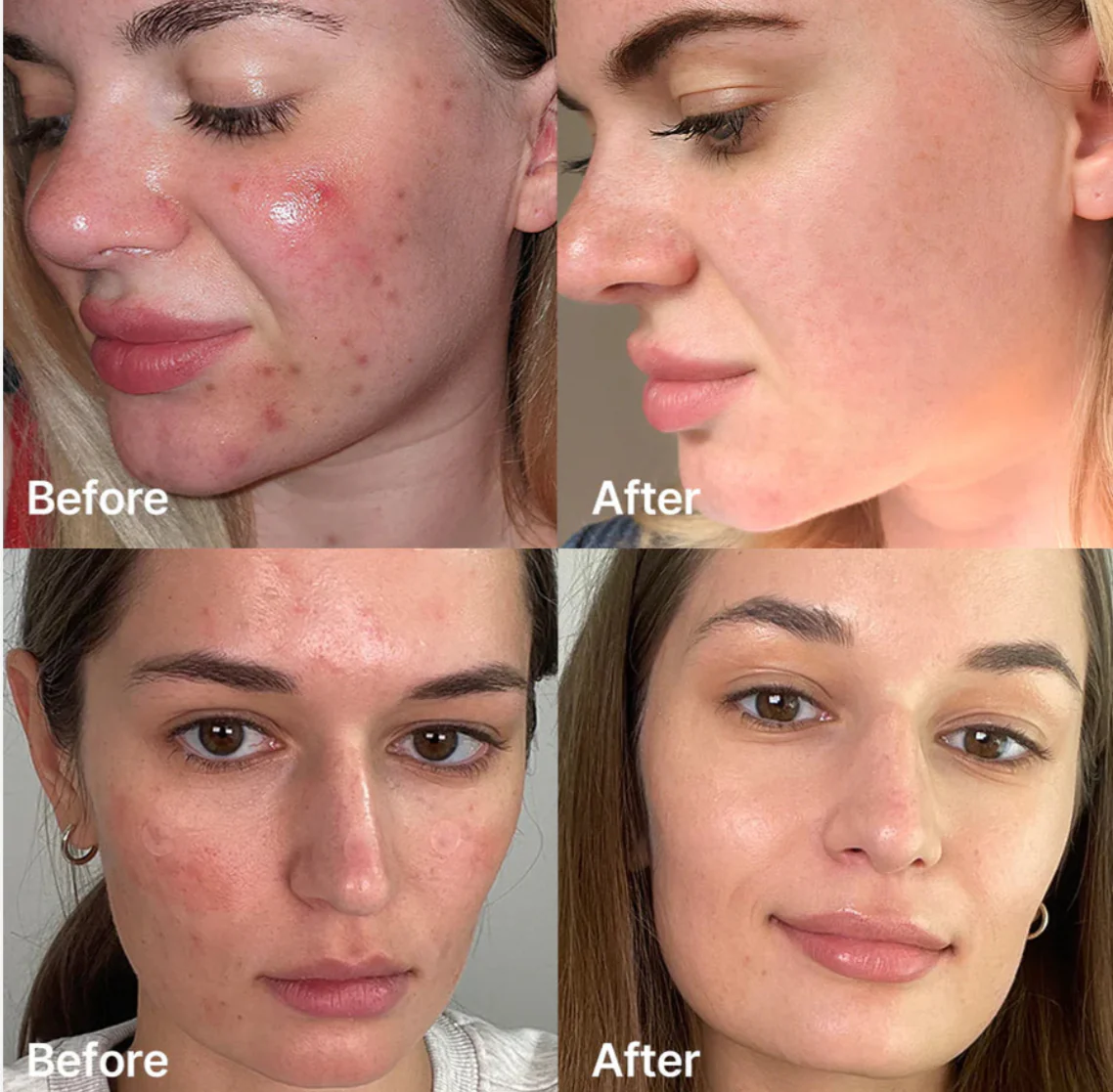 Medicube Red Succinic Acid Serum